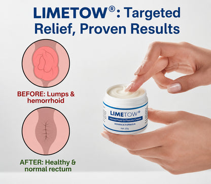 🔥𝙇𝙞𝙢𝙞𝙩𝙚𝙙-𝙏𝙞𝙢𝙚 𝙊𝙛𝙛𝙚𝙧 | LIMETOW® 𝗛𝗲𝗺𝗼𝗿𝗿𝗵𝗼𝗶𝗱 & 𝗙𝗶𝘀𝘀𝘂𝗿𝗲 𝗖𝗿𝗲𝗮𝗺