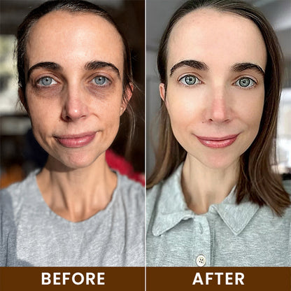 LIMETOW® Intensive Bee Venom Eye Cream
