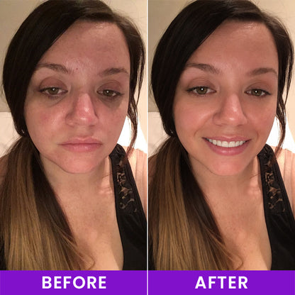 LIMETOW® 0.1% Caffeine Revitalizing Eye Cream