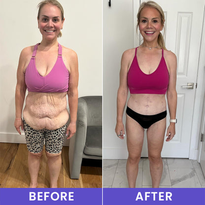 LIMETOW® Tighten & Smooth Belly Firming Cream