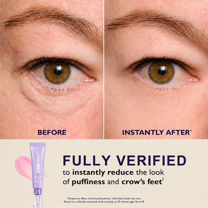 LIMETOW™ Instant Eye Tightener - Tightens, Firms, & Blurs Wrinkles