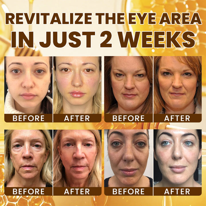 LIMETOW® Intensive Bee Venom Eye Cream