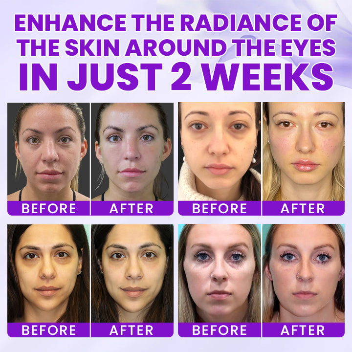 LIMETOW® 0.1% Caffeine Revitalizing Eye Cream