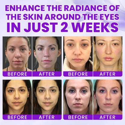 LIMETOW® 0.1% Caffeine Revitalizing Eye Cream