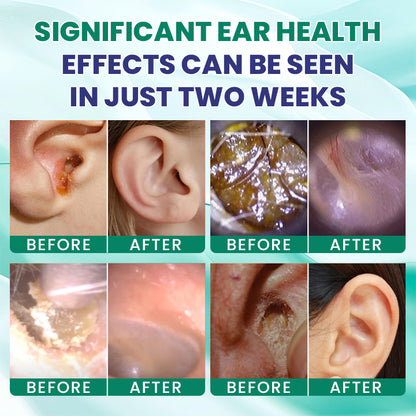 LIMETOW® Tinnitus Ear Drops