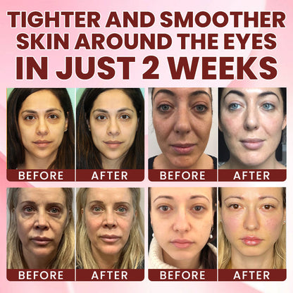 LIMETOW® Collagen & Niacinamide Anti-Wrinkle & Firming Eye Cream