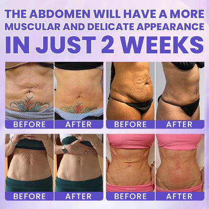 LIMETOW® Tighten & Smooth Belly Firming Cream