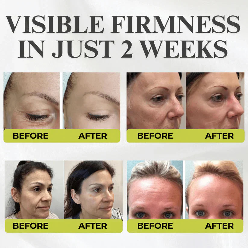 👏🌿Made and shipped from the USA 💫Botox & Vita-A Retinol Shot Wrinkle-Lift Tightening cream - Last Day Promotion 50% OFF