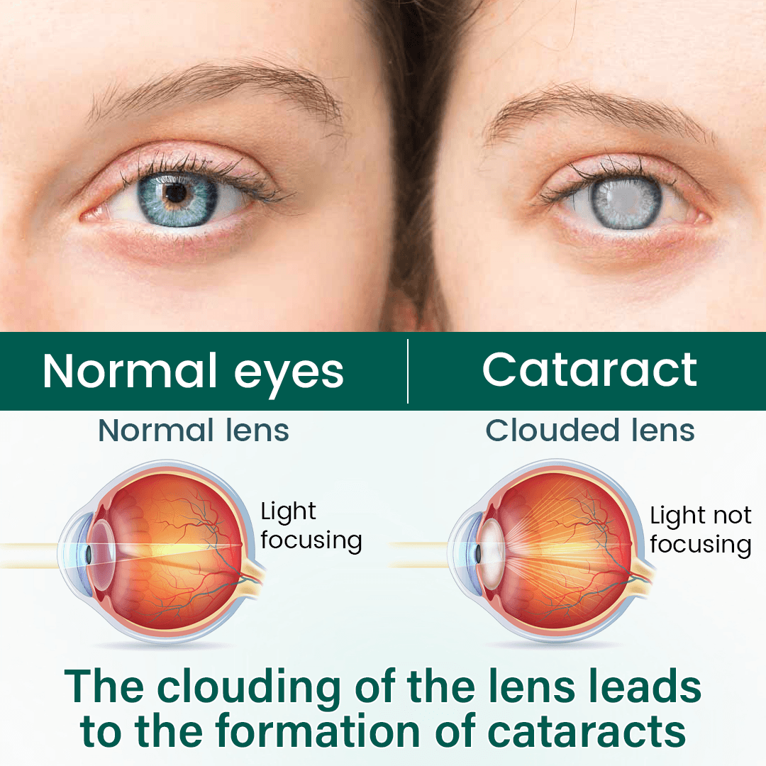 BalanceVie OptiClear Nano Eye Roller Serum