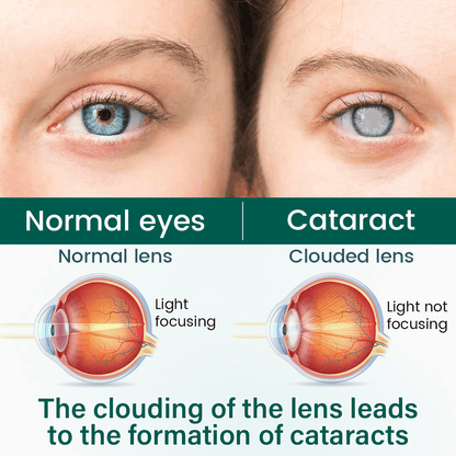 BalanceVie OptiClear Nano Eye Roller Serum