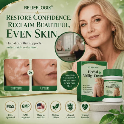 LIMETOW® Herbal Care Cream Targets Vitiligo to Restore Visible Skin Pigment